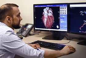 Dr. Moneal Shah studies the results from the HeartFlow Analysis