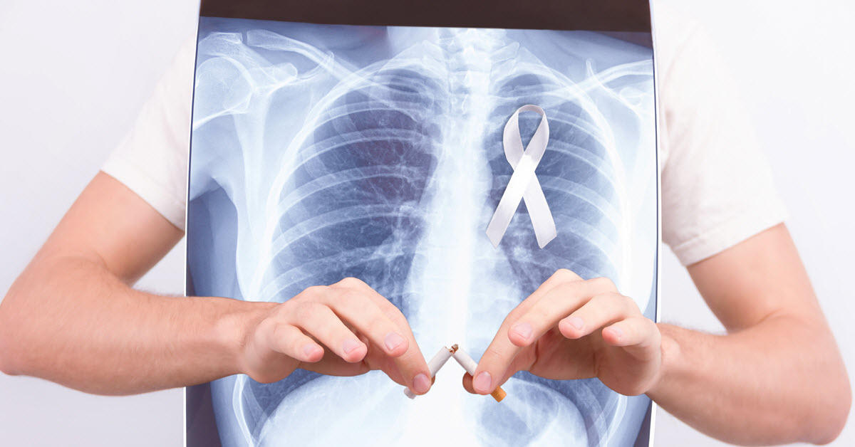 For Lung Cancer Awareness Month, be aware that your number one risk for getting lung cancer is smoking — but if you have smoked the equivalent of a pack a day for 30 years, a lung cancer screening can heap detect cancer early when it is most treatable.