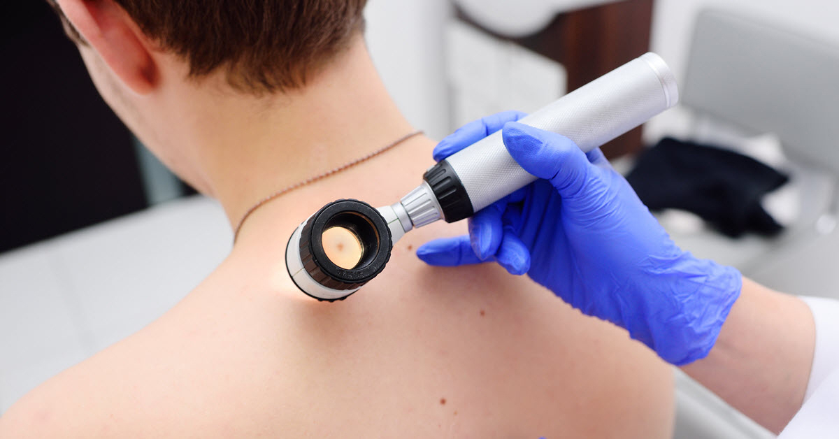 Dr. Edington emphasizes the importance of being screened for melanoma and skin cancer by a dermatologist, particularly if you have risk factors or notice anything abnormal or changing about your moles. 