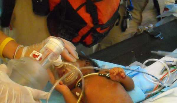 Close-up of a baby being given oxygen